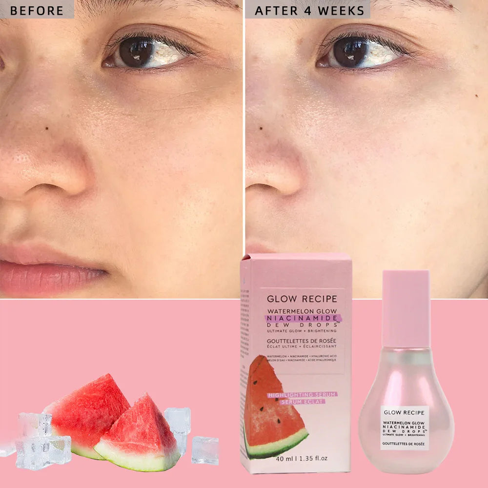 Glow recipe - sérum watermelon glow niacinamide dew drops